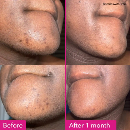 Good Molecules Brightening & Dark Spots Bar 1 Bar