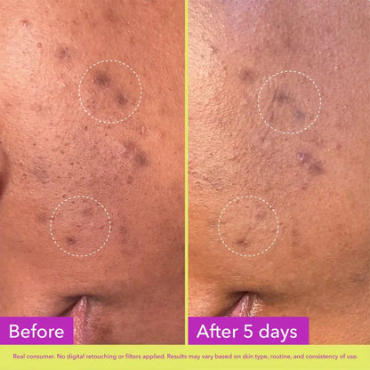Good Molecules Dark Spot Microdart Patches 24 Patches