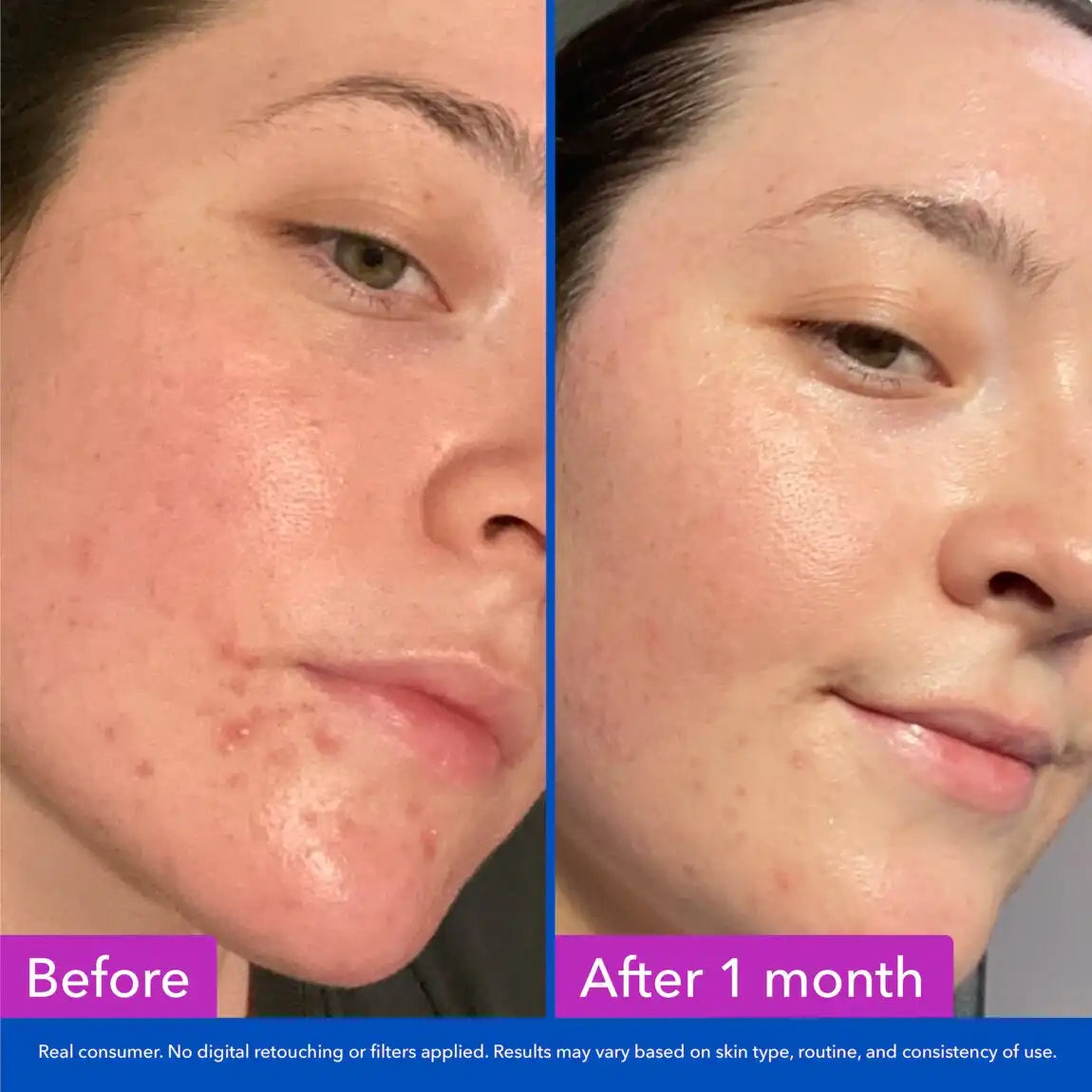 Good Molecules Clarify & Cleanse Bar 1 Bar