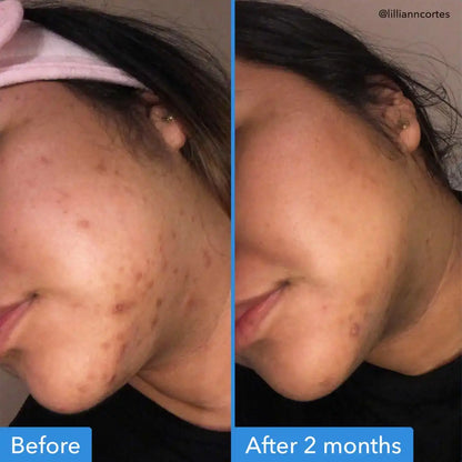Good Molecules Discoloration Correcting Serum 30 ml
